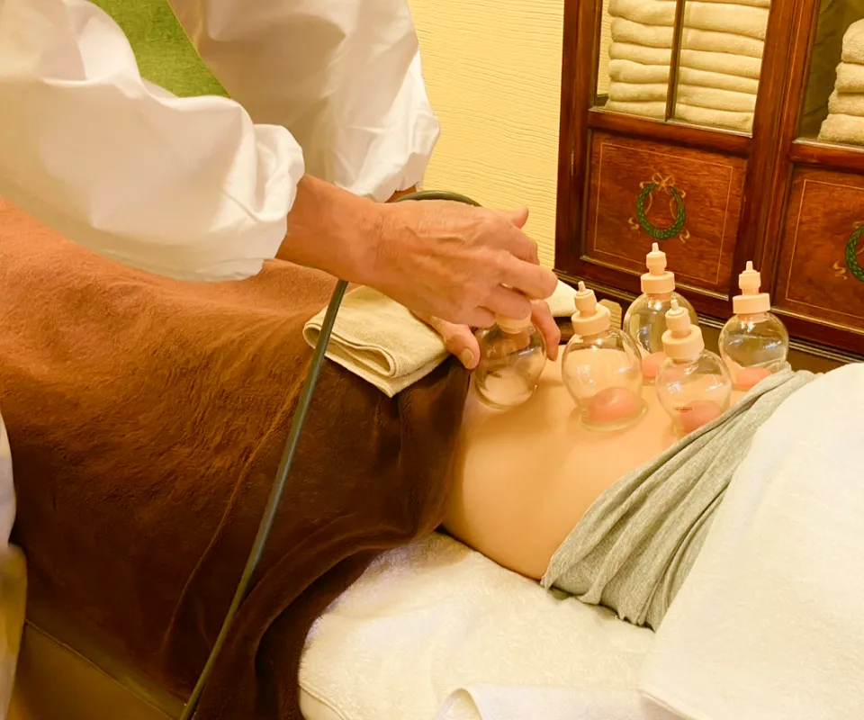 吸い玉施術の様子