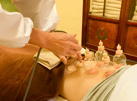 吸い玉施術の様子